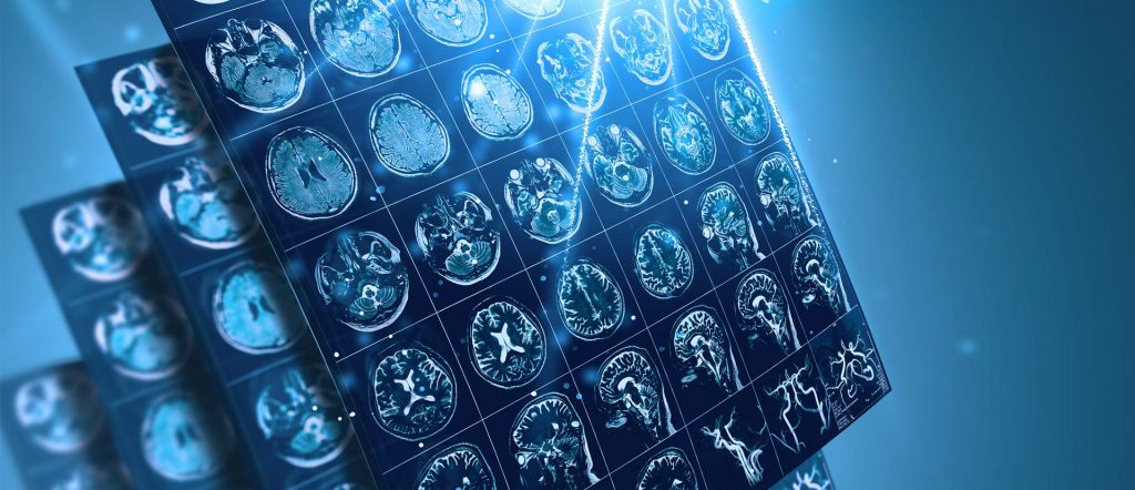 brain scans brain scans