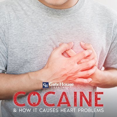 heart-disease-cocaine-addiction-treatment-options