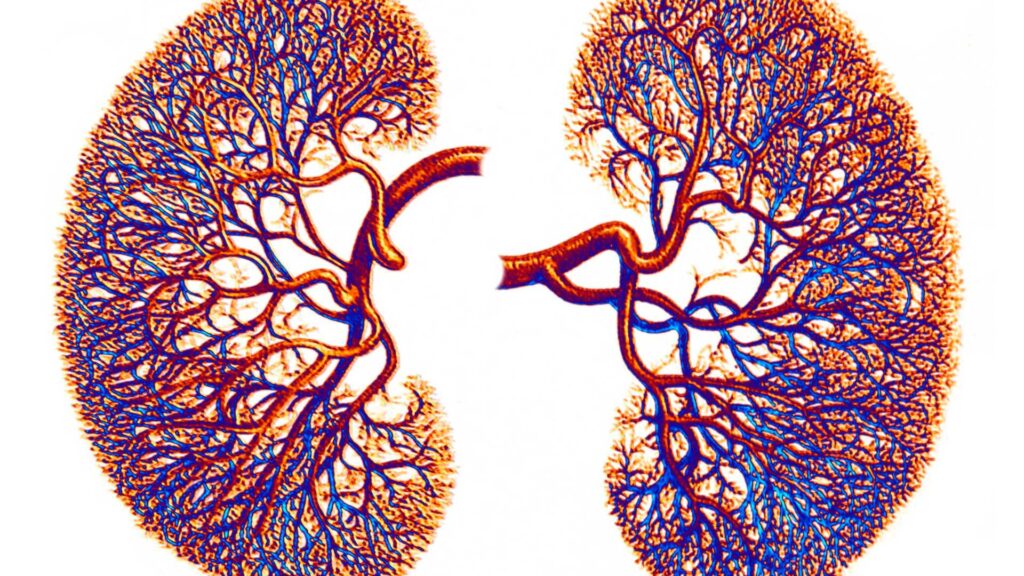 Alcohol's impact on the kidneys: an image of a kidney's circulation system.